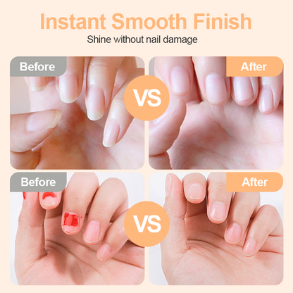 ✂️💅 2-in-1 Smart Electric Nail Clipper & Polisher 🌟